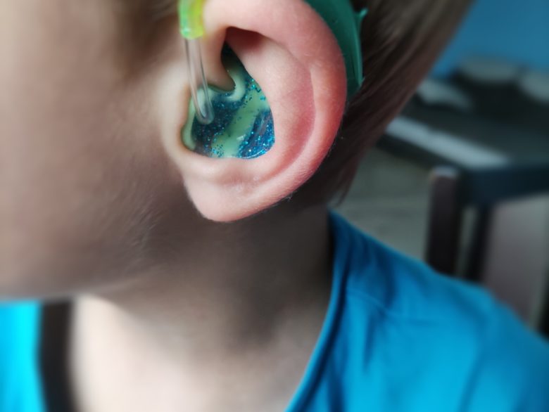 aparat słuchowy dla dziecka