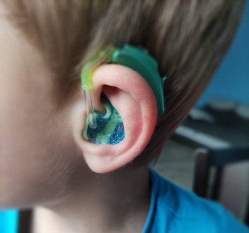 aparat słuchowy dla dziecka